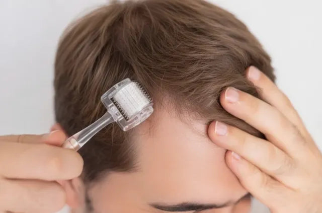 Microneedling before and after used on mans scalp