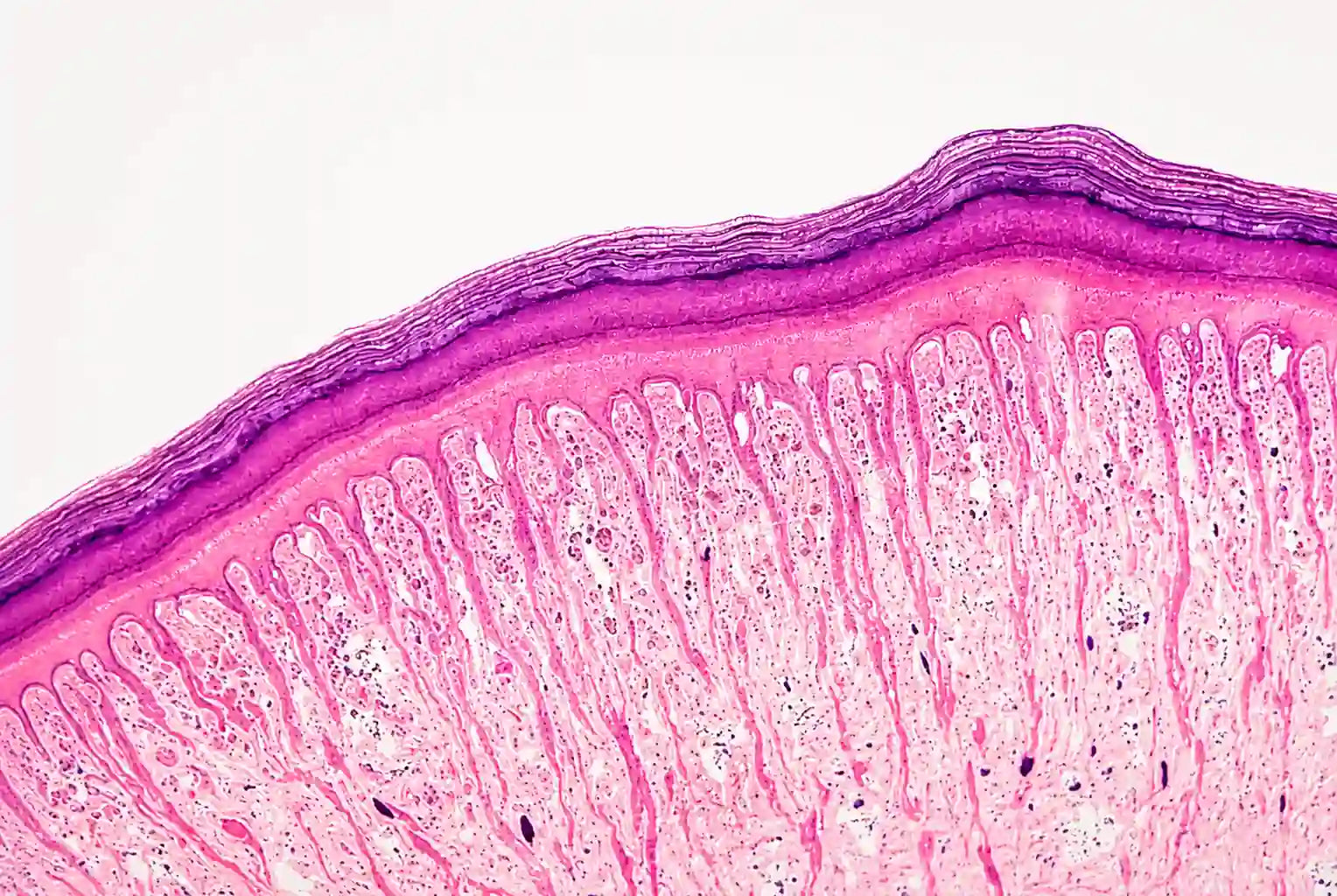 Skin Barrier Repair: How to Restore, Protect & Strengthen a Damaged Skin Barrier