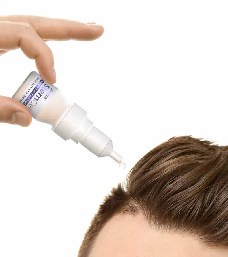 man applying skinara hair growth serum to his scalp with a dropper bottle