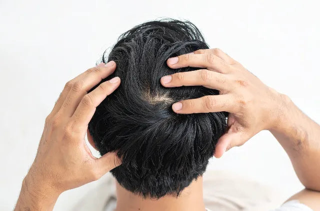 Best hair growth serum being applied to mans scalp