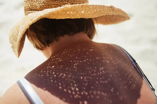 Anti wrinkle sunscreen showing woman wearing a straw sun hat