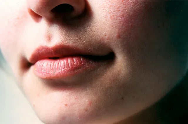 Skin Barrier Repair: How to Restore, Protect & Strengthen a Damaged Skin Barrier