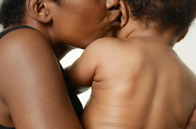 Mom cuddling baby, showing sensitive skin care, skin therapy, and probiotics for clear skin before and after sun