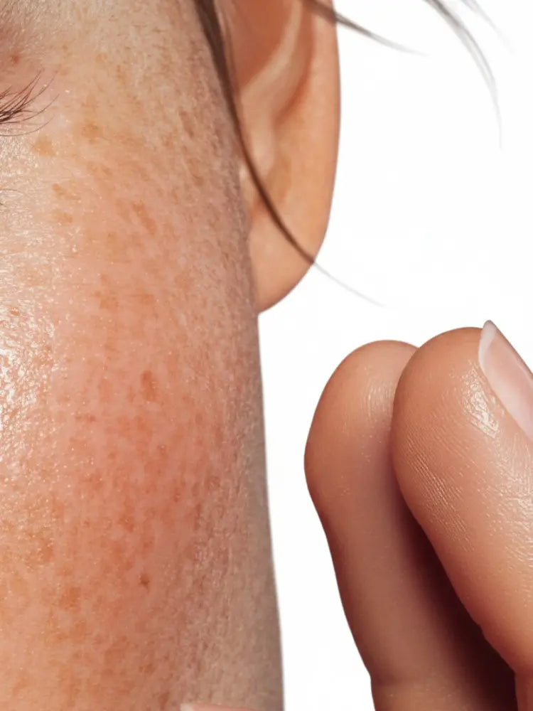 Close-up of a person's ear and neck with visible skin texture on a white background